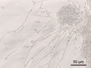 what-is-candida-infection