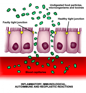Leaky Gut