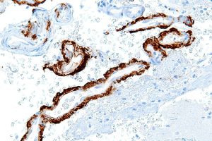 how-to-help-with-alzheimer