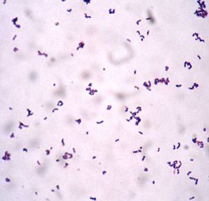 how-to-help-with-alzheimer